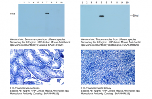 Lab Secondary‑Antibody Selection Guide: Cloud‑Clone Shares Tips for Efficient Reagent Matching